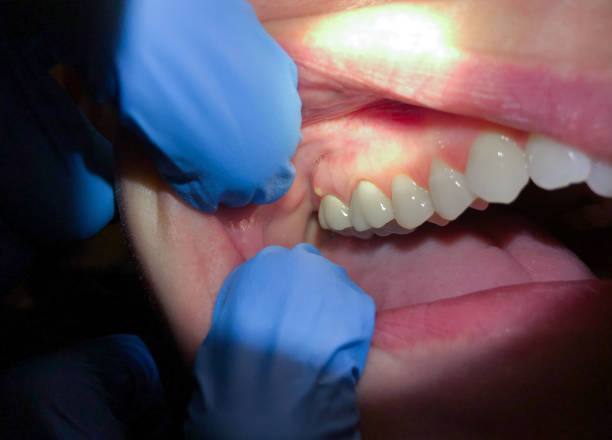 Best Pediatric Emergency Dentist in Mountainair, NM
